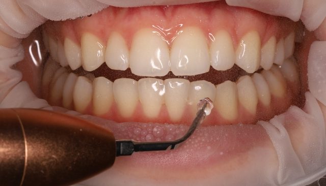 Studio dentistico Barbara Sica Lorenzo Tedeschi - Sanremo - controlli periodici